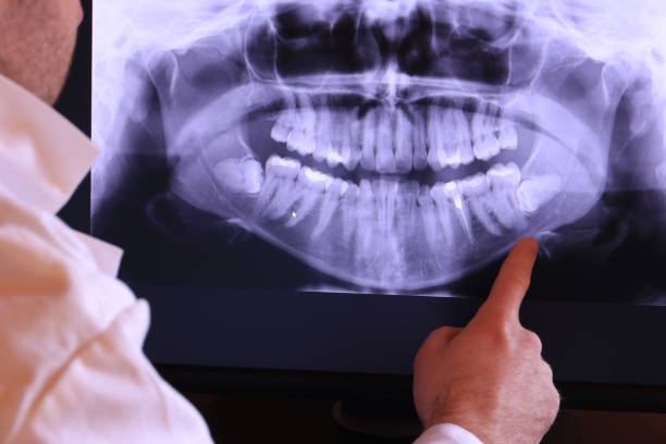 Best Broken Tooth Emergency  in Suncrest, WA